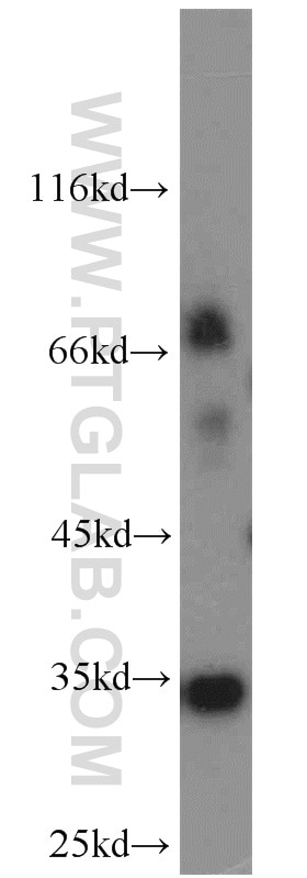 Western Blot (WB) analysis of mouse kidney tissue using tPA Polyclonal antibody (10147-1-AP)