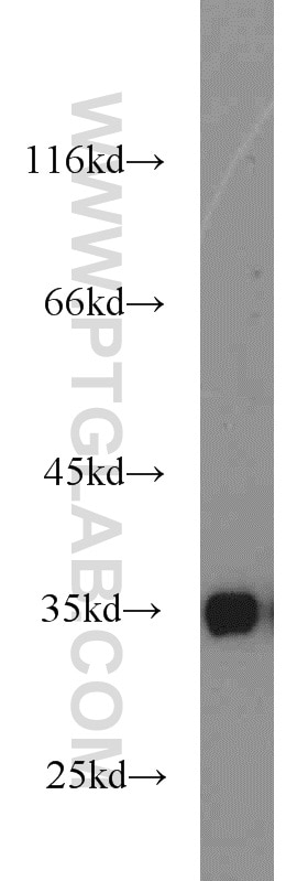 WB analysis of mouse pancreas using 10147-1-AP