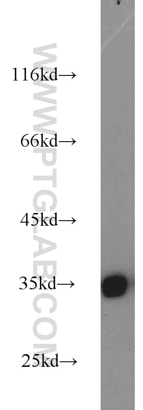 WB analysis of mouse pancreas using 10147-1-AP