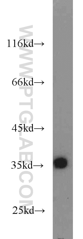 WB analysis of mouse pancreas using 10147-1-AP