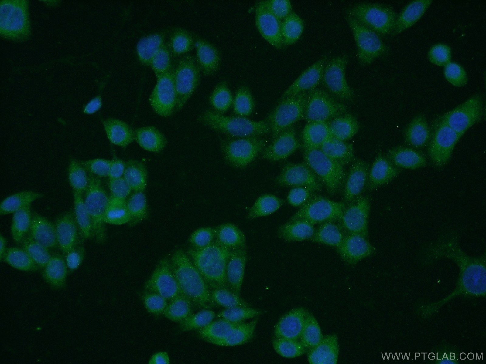 Immunofluorescence (IF) / fluorescent staining of HeLa cells using uPA/Urokinase Polyclonal antibody (17968-1-AP)