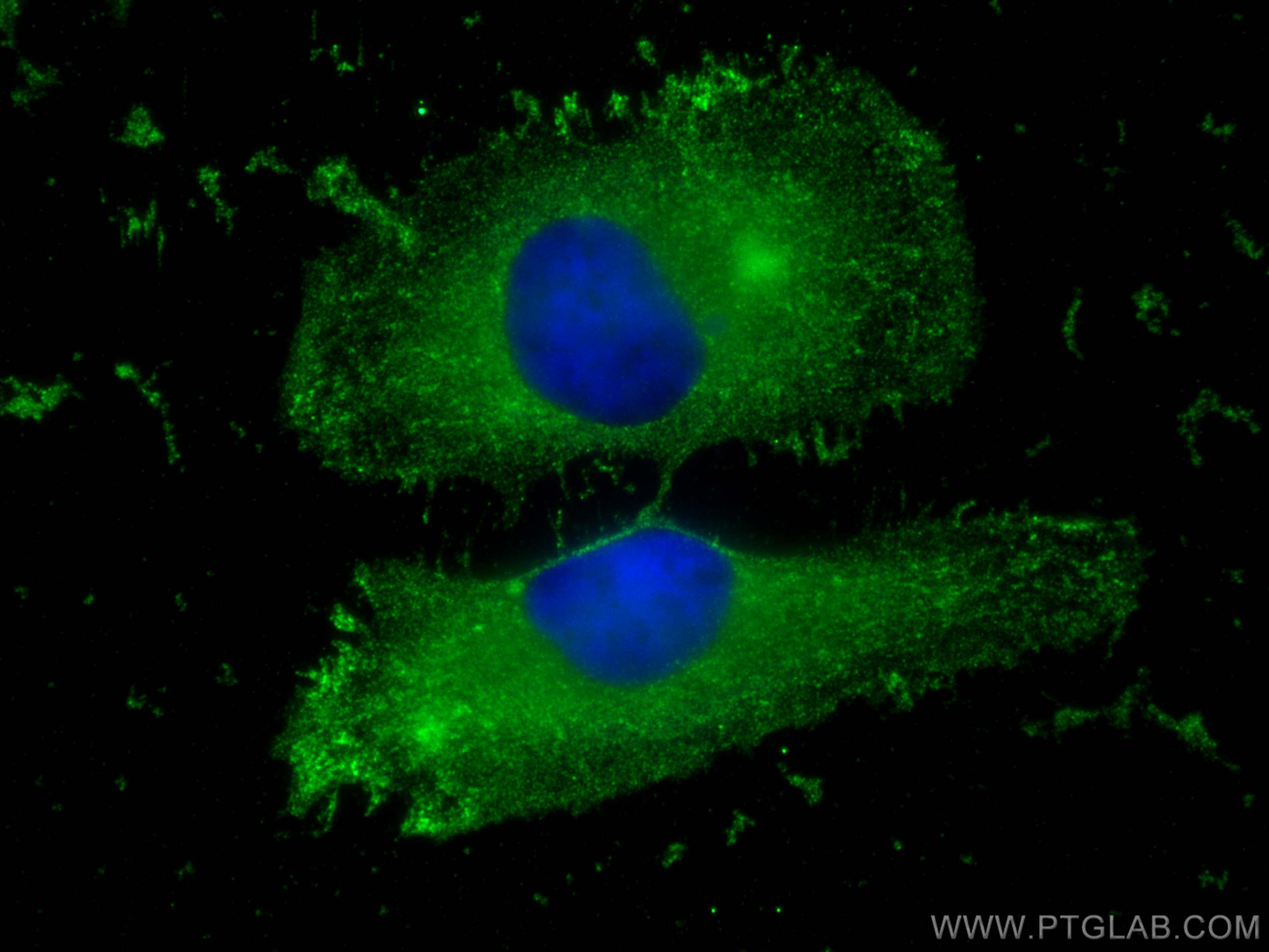 Immunofluorescence (IF) / fluorescent staining of HeLa cells using uPA/Urokinase Polyclonal antibody (17968-1-AP)