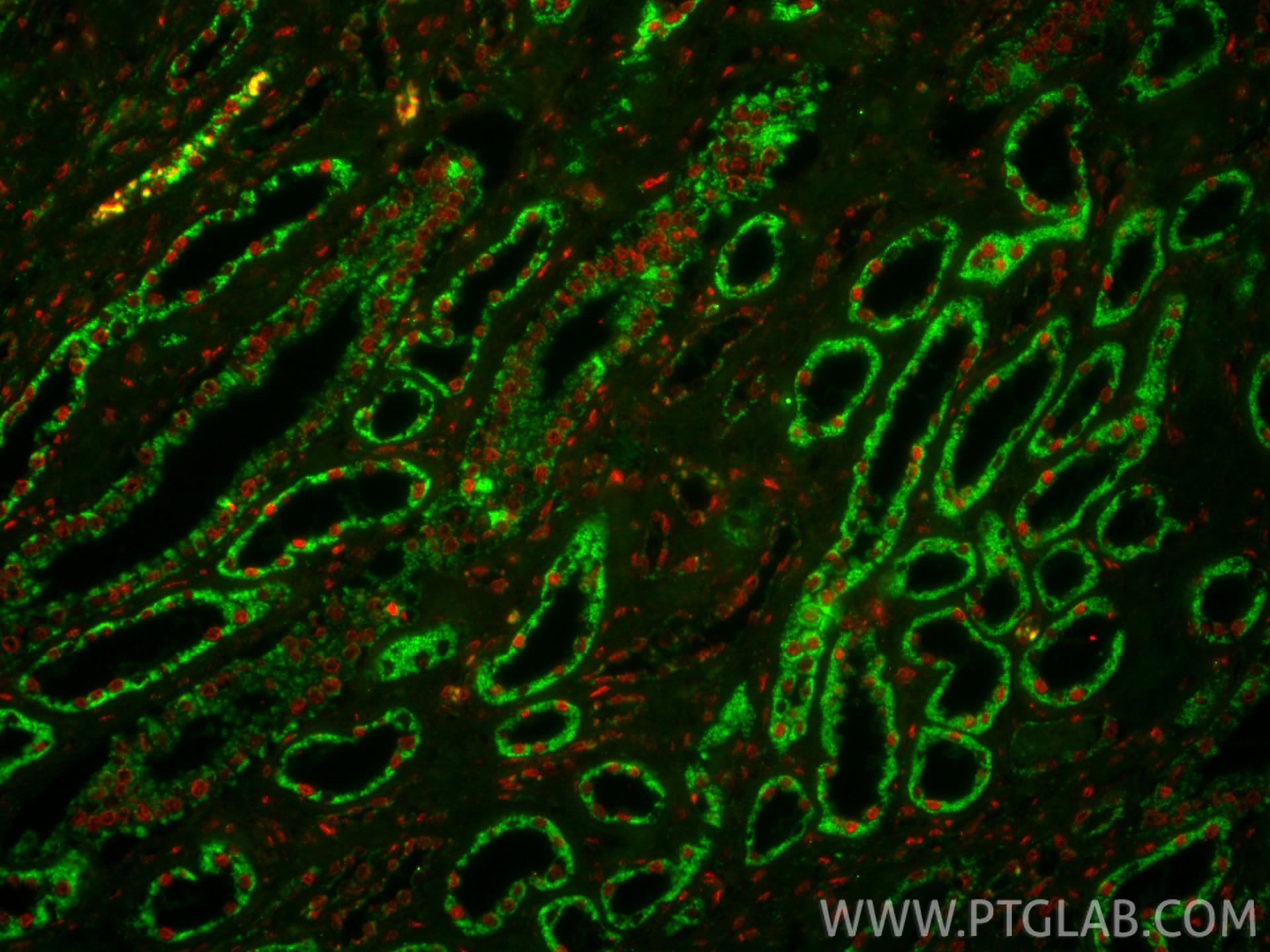 IF Staining of human kidney using 17968-1-AP Immunofluorescence (IF) / fluorescent staining of human kidney tissue using uPA/Urokinase Polyclonal antibody (17968-1-AP)