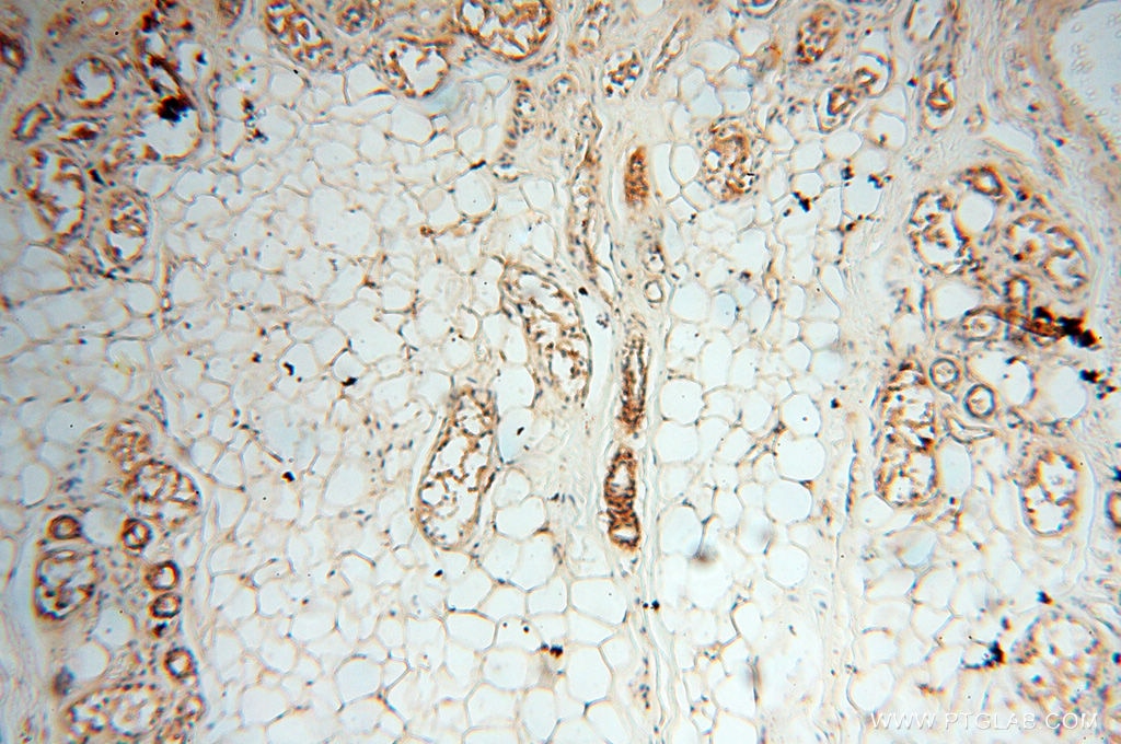 Immunohistochemistry (IHC) staining of human skin tissue using uPA/Urokinase Polyclonal antibody (17968-1-AP)