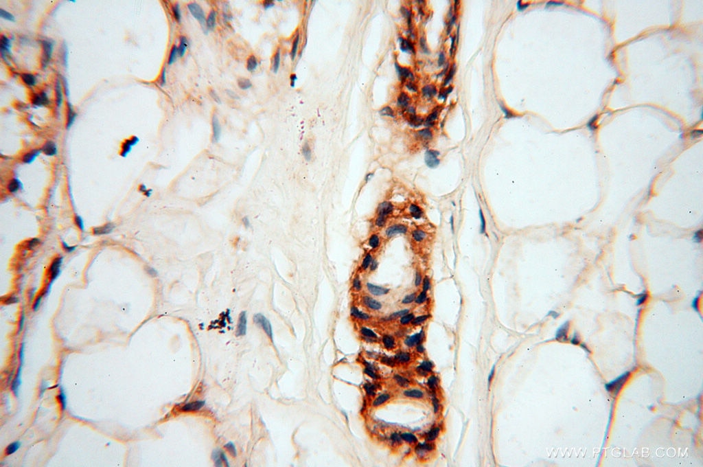 Immunohistochemistry (IHC) staining of human skin tissue using uPA/Urokinase Polyclonal antibody (17968-1-AP)