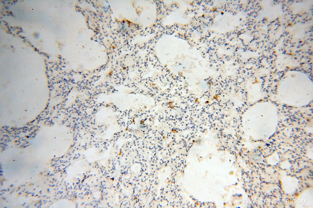 IHC staining of human lung using 17968-1-AP