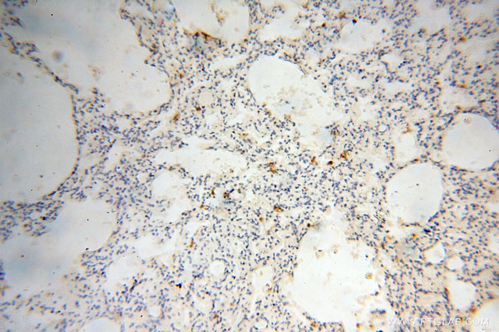 Immunohistochemistry (IHC) staining of human lung tissue using uPA/Urokinase Polyclonal antibody (17968-1-AP)