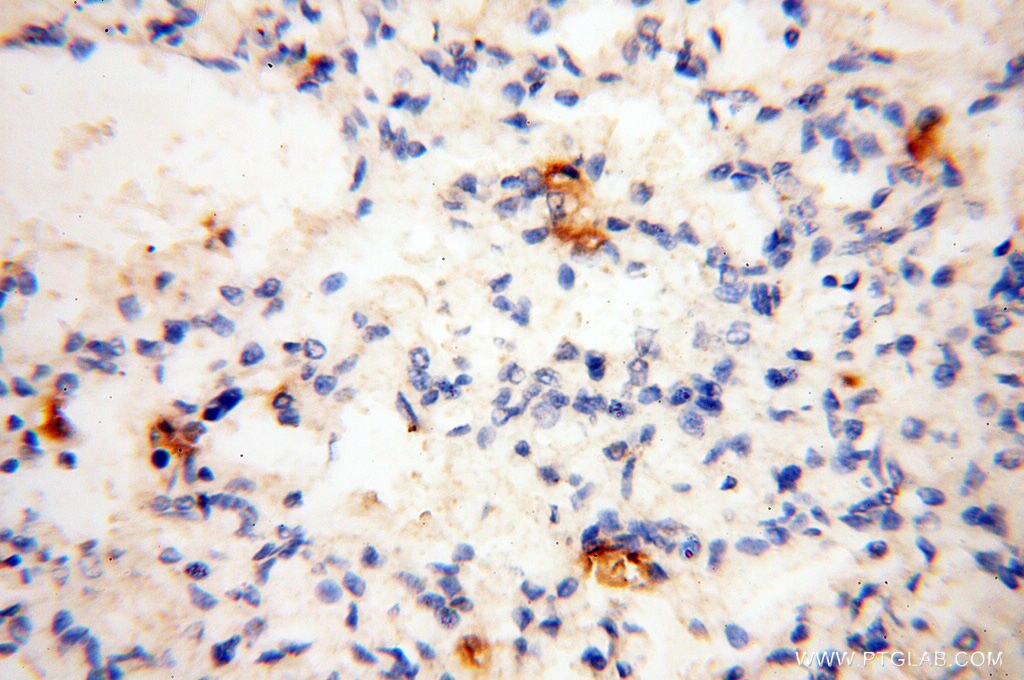 Immunohistochemistry (IHC) staining of human lung tissue using uPA/Urokinase Polyclonal antibody (17968-1-AP)