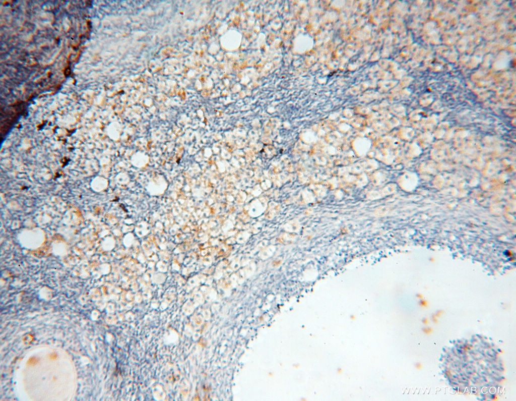 Immunohistochemistry (IHC) staining of human ovary tissue using uPA/Urokinase Polyclonal antibody (17968-1-AP)