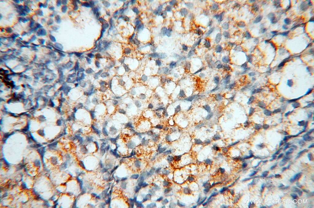 IHC staining of human ovary using 17968-1-AP