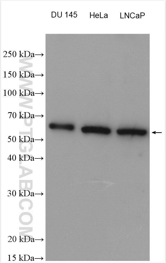 Western Blot (WB) analysis of various lysates using uPA/Urokinase Polyclonal antibody (17968-1-AP)