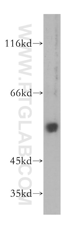 uPA/Urokinase Polyclonal antibody