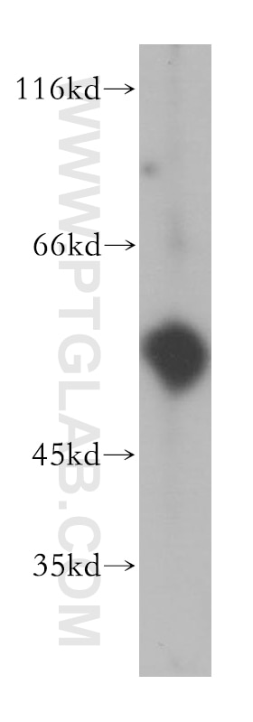 Western Blot (WB) analysis of human brain tissue using uPA/Urokinase Polyclonal antibody (17968-1-AP)