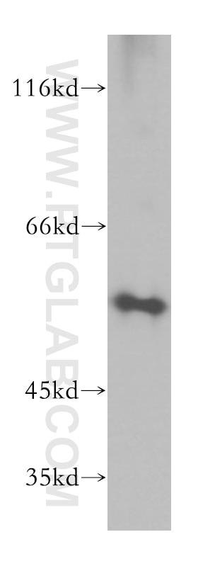 Western Blot (WB) analysis of A375 cells using uPA/Urokinase Polyclonal antibody (17968-1-AP)