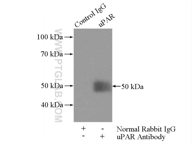 Immunoprecipitation (IP) experiment of RAW 264.7 cells using uPAR Polyclonal antibody (10286-1-AP)