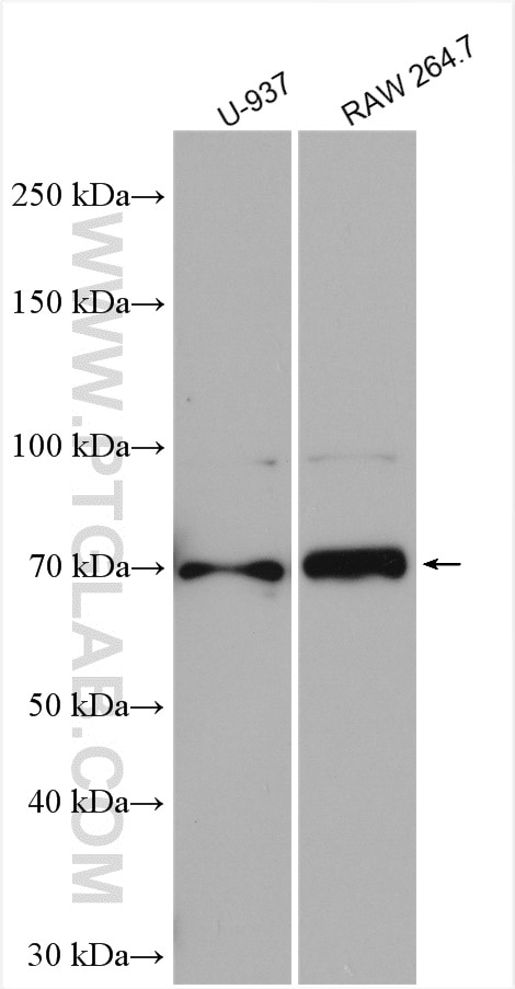 Western Blot (WB) analysis of various lysates using uPAR Polyclonal antibody (10286-1-AP)