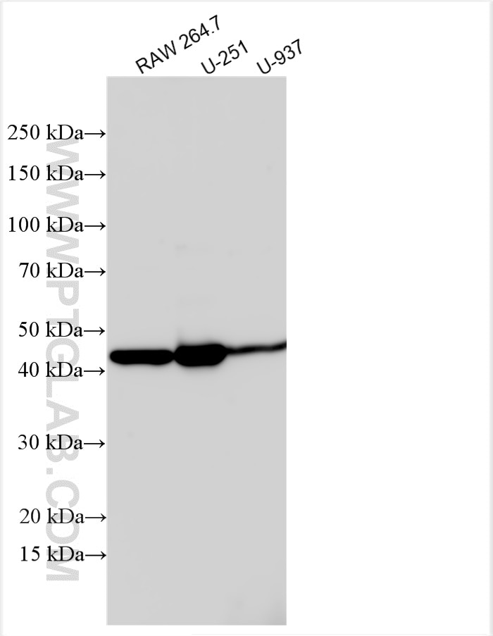 Western Blot (WB) analysis of various lysates using uPAR Polyclonal antibody (10286-1-AP)