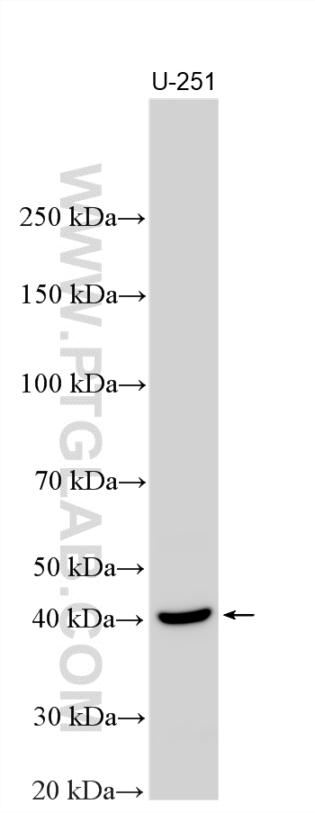 Western Blot (WB) analysis of various lysates using uPAR/CD87 Polyclonal antibody (10286-1-AP)
