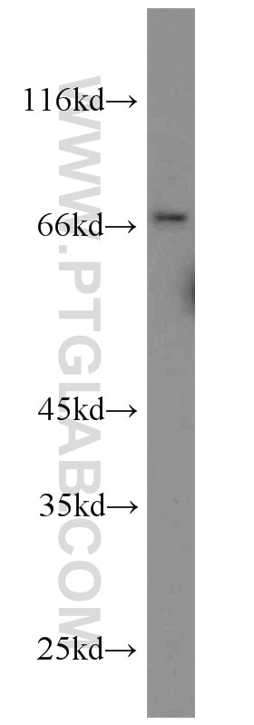 uPAR Polyclonal antibody