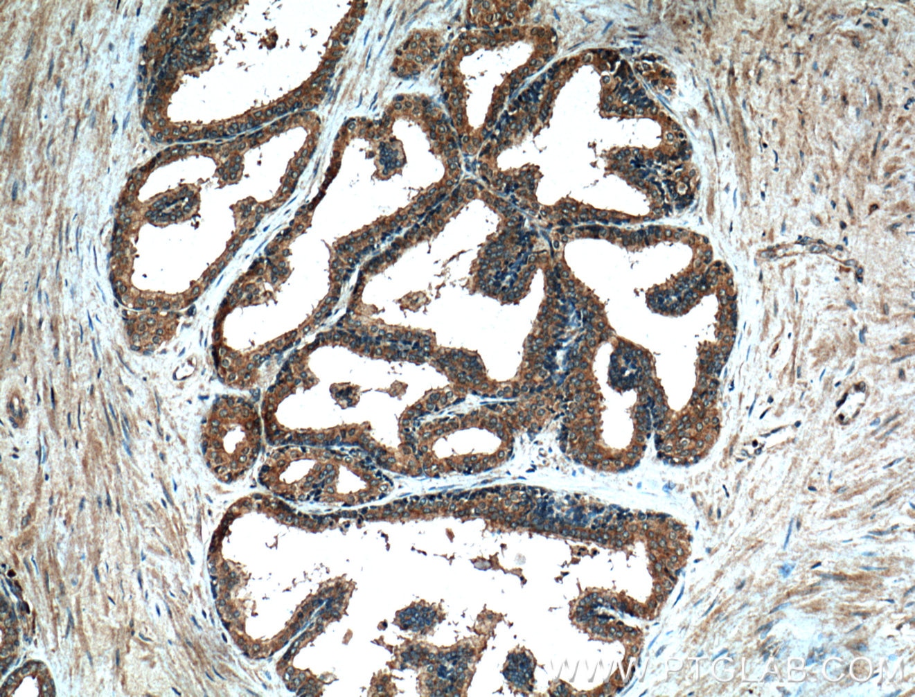 Immunohistochemistry (IHC) staining of human prostate hyperplasia tissue using PLB1 Polyclonal antibody (26835-1-AP)