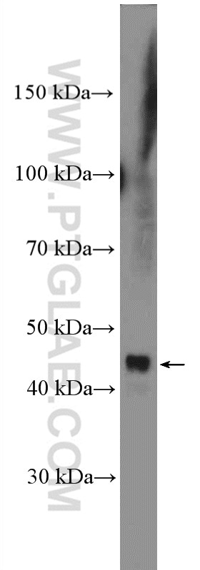 Western Blot (WB) analysis of DU 145 cells using PLB1 Polyclonal antibody (26835-1-AP)