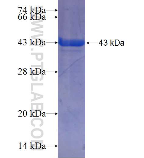 PLB1 fusion protein Ag25240 SDS-PAGE