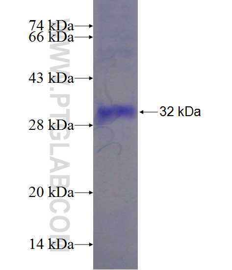 PLBD1 fusion protein Ag21980 SDS-PAGE
