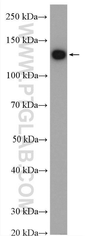 Western Blot (WB) analysis of mouse brain tissue using Phospholipase C Beta 1 Polyclonal antibody (26551-1-AP)