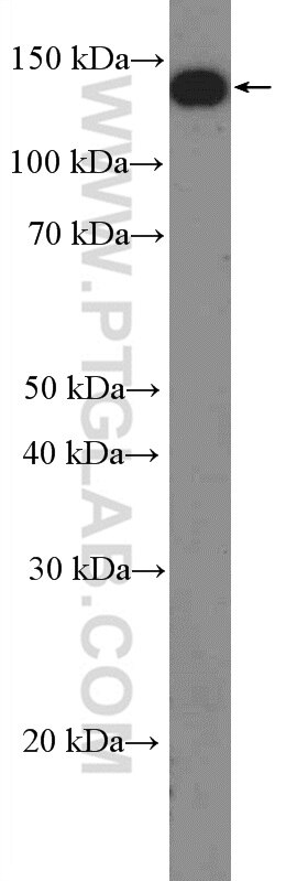 Western Blot (WB) analysis of rat brain tissue using Phospholipase C Beta 1 Polyclonal antibody (26551-1-AP)