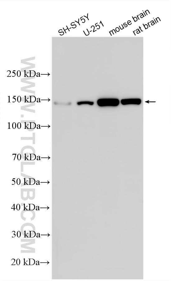Various lysates were subjected to SDS PAGE followed by western blot with 26551-1-AP (Phospholipase C Beta 1 antibody) at dilution of 1:1000 incubated at room temperature for 1.5 hours. Western Blot (WB) analysis of various lysates using Phospholipase C Beta 1 Polyclonal antibody (26551-1-AP)