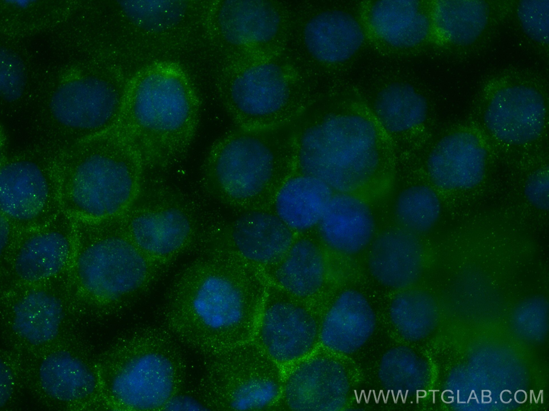 Immunofluorescence (IF) / fluorescent staining of THP-1 cells using PLCB2 Polyclonal antibody (27456-1-AP)