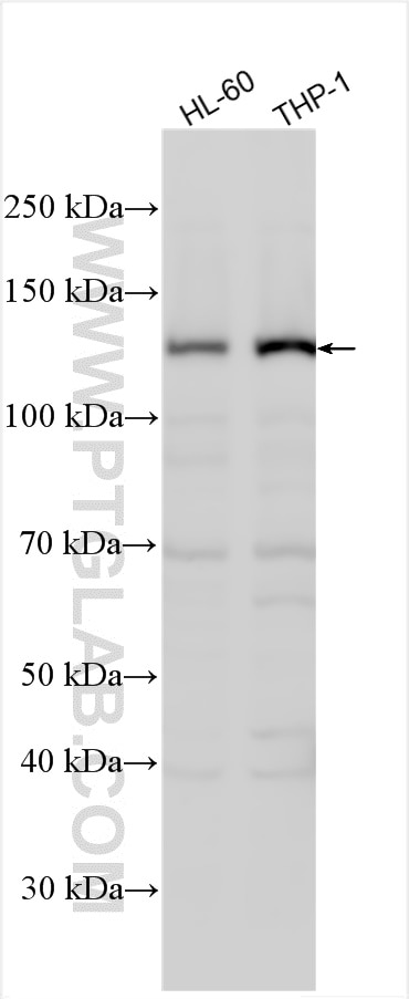 Western Blot (WB) analysis of various lysates using PLCB2 Polyclonal antibody (27456-1-AP)