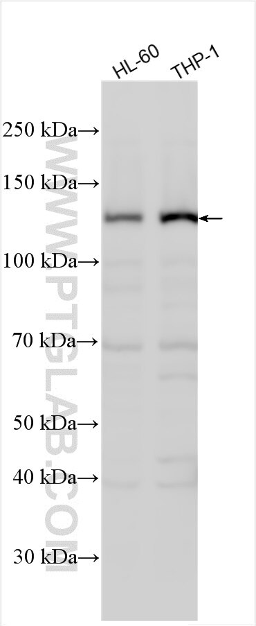 Western Blot (WB) analysis of various lysates using PLCB2 Polyclonal antibody (27456-1-AP)