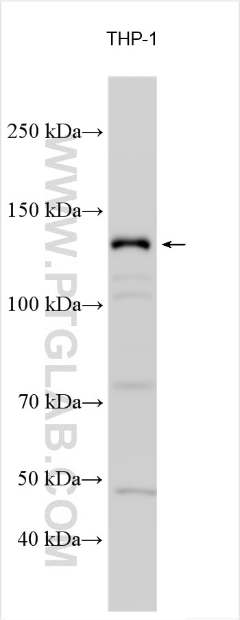 Western Blot (WB) analysis of various lysates using PLCB2 Polyclonal antibody (27456-1-AP)