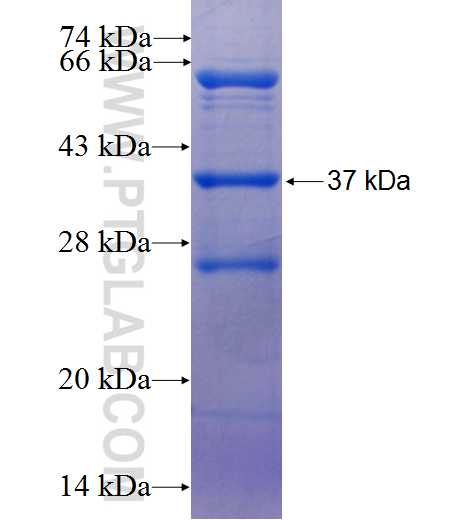 PLCB2 fusion protein Ag25771 SDS-PAGE