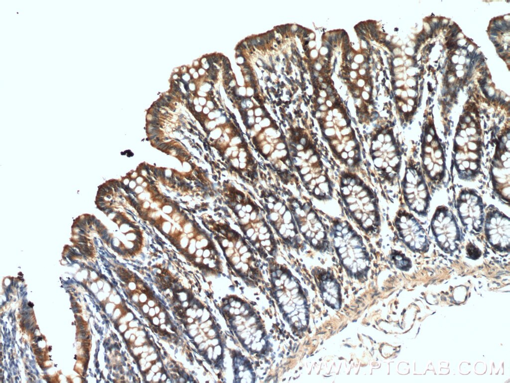 Immunohistochemistry (IHC) staining of human colon tissue using PLCB3 Polyclonal antibody (21370-1-AP)