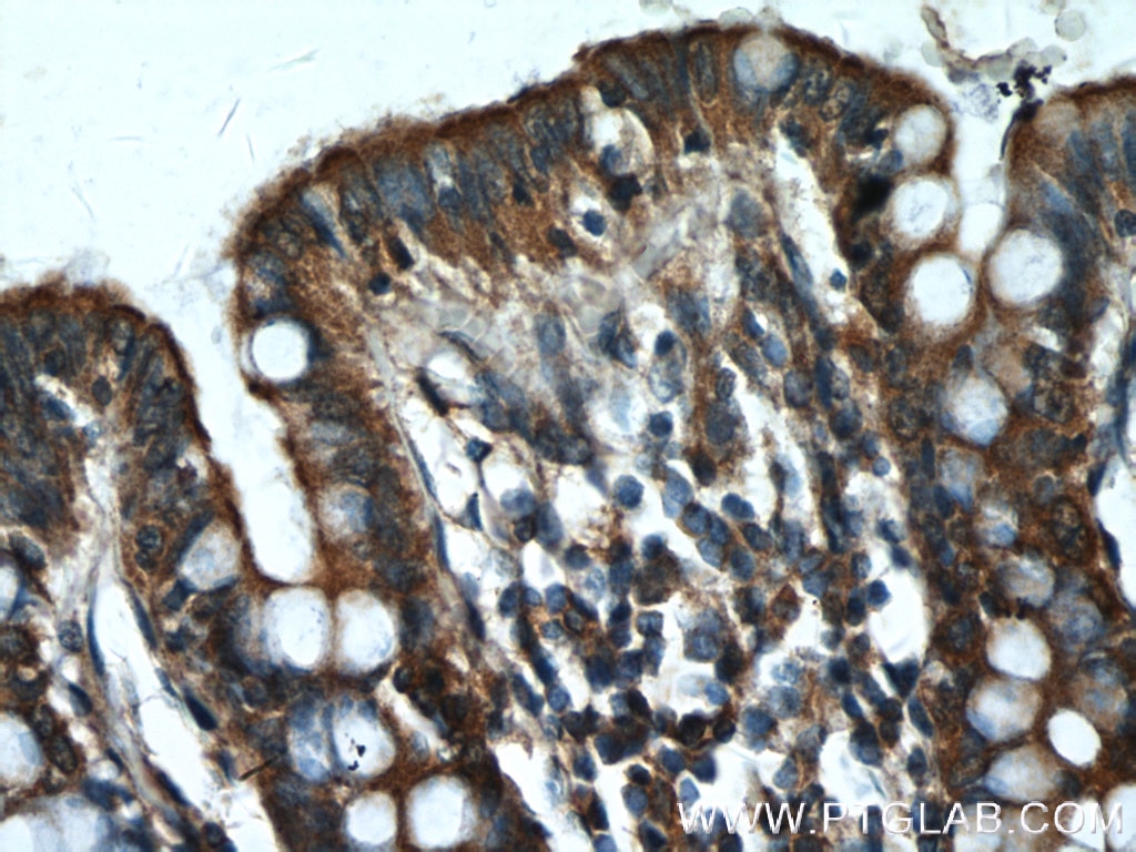 Immunohistochemistry (IHC) staining of human colon tissue using PLCB3 Polyclonal antibody (21370-1-AP)