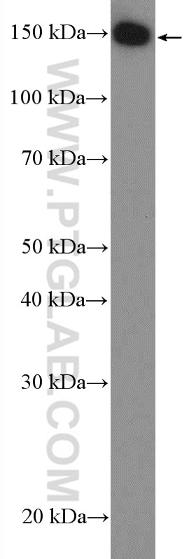 Western Blot (WB) analysis of MCF-7 cells using PLCB3 Polyclonal antibody (21370-1-AP)