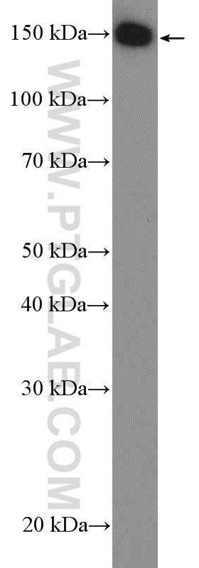 WB analysis of MCF-7 using 21370-1-AP