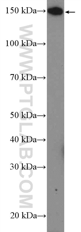 Western Blot (WB) analysis of NIH/3T3 cells using PLCB3 Polyclonal antibody (21370-1-AP)