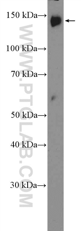 Western Blot (WB) analysis of HEK-293T cells using PLCB3 Polyclonal antibody (21370-1-AP)