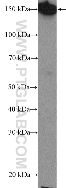 Western Blot (WB) analysis of COLO 320 cells using PLCB3 Polyclonal antibody (21370-1-AP)