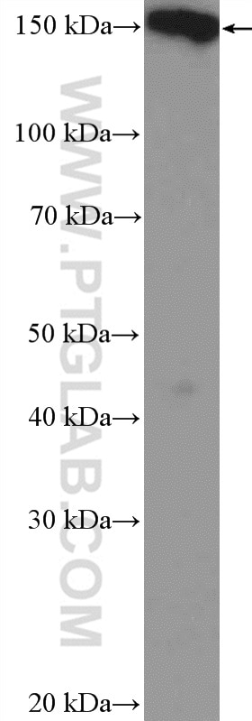 Western Blot (WB) analysis of A431 cells using PLCB3 Polyclonal antibody (21370-1-AP)