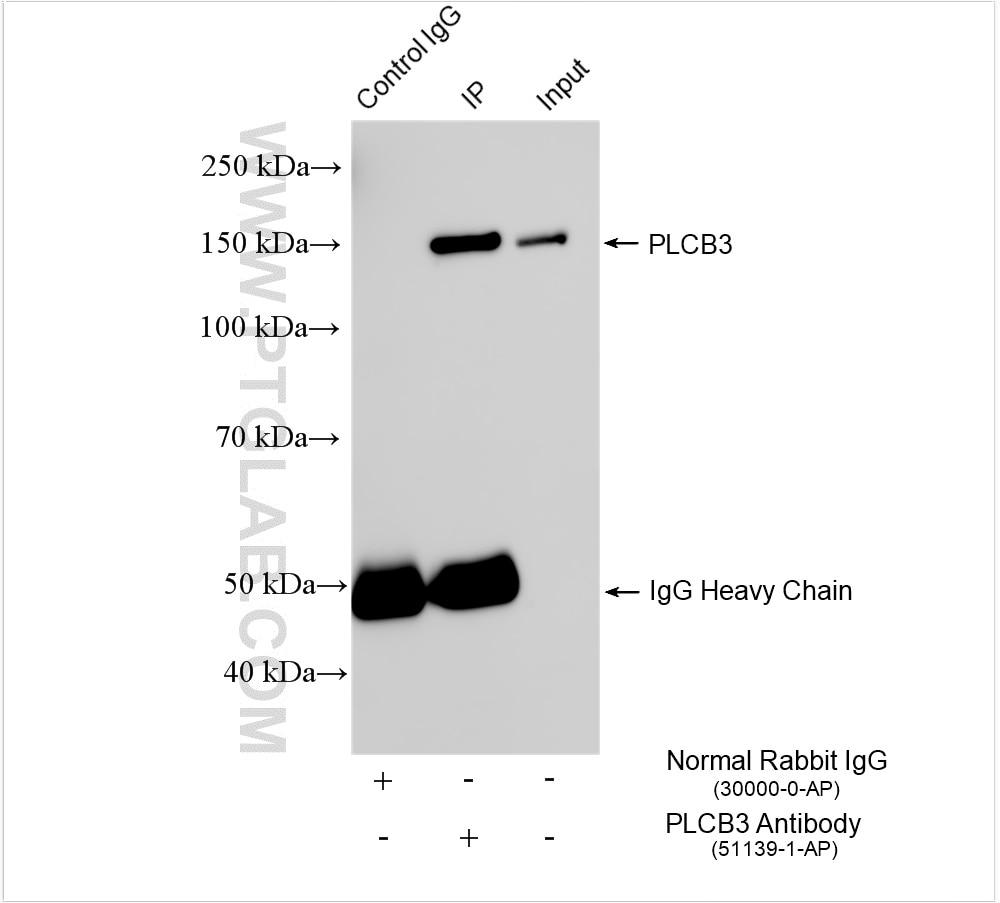Immunoprecipitation (IP) experiment of MDA-MB-231 cells using PLCB3 Polyclonal antibody (51139-1-AP)
