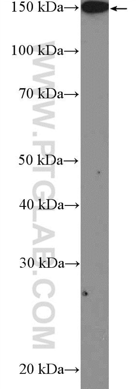 Western Blot (WB) analysis of MCF-7 cells using PLCB3 Polyclonal antibody (51139-1-AP)