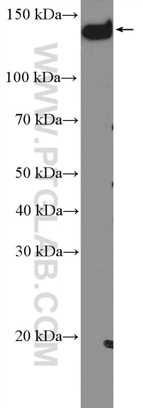 Western Blot (WB) analysis of HeLa cells using PLCB3 Polyclonal antibody (51139-1-AP)