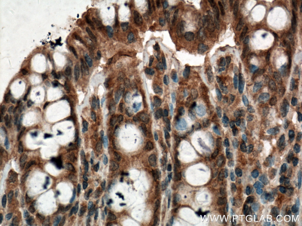 Immunohistochemistry (IHC) staining of human colon tissue using PLCB3 Monoclonal antibody (66668-1-Ig)