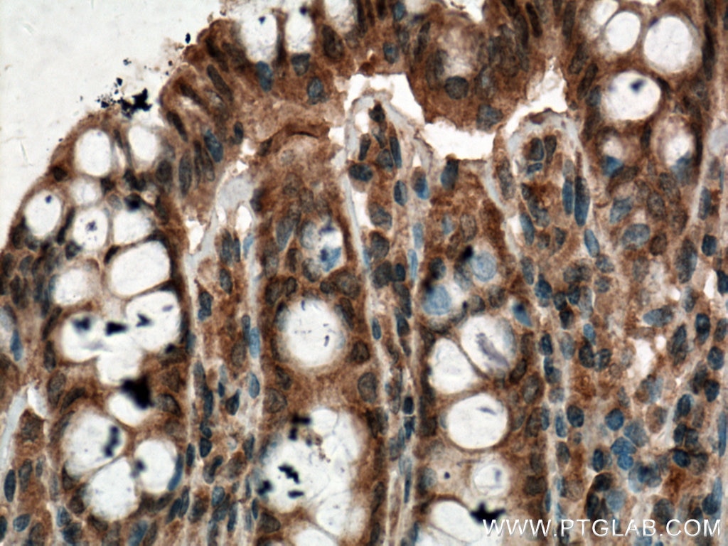 IHC staining of human colon using 66668-1-Ig