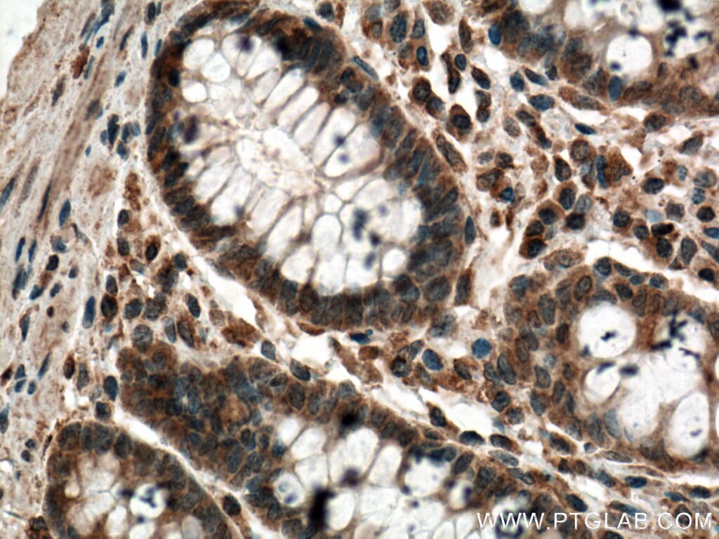 Immunohistochemistry (IHC) staining of human colon tissue using PLCB3 Monoclonal antibody (66668-1-Ig)