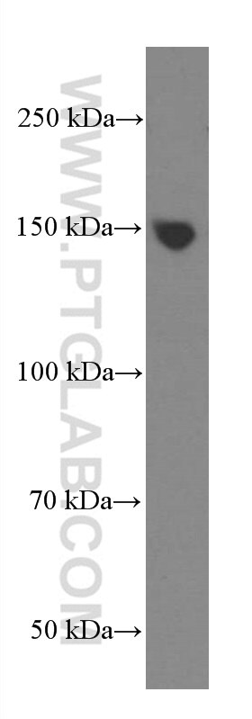 Western Blot (WB) analysis of Jurkat cells using PLCB3 Monoclonal antibody (66668-1-Ig)